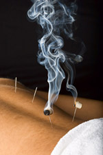 Moxibustion