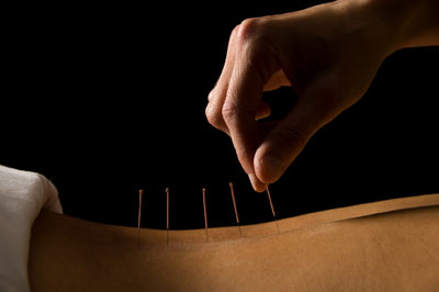 Twisting Acupuncture Needles